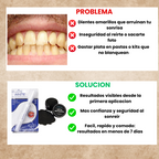 Combo Blanqueador LuminaSmile